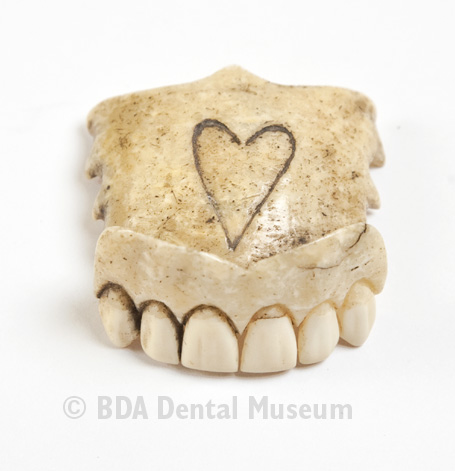 Image of partial denture