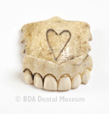 Image of partial denture